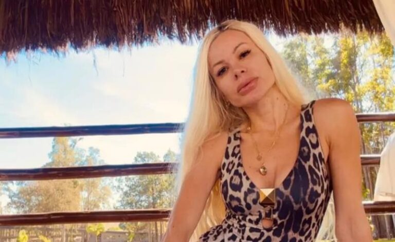 Fhabi Hanna fala sobre autoestima após trauma de saúde: “Hoje me sinto mais bonita sendo real”